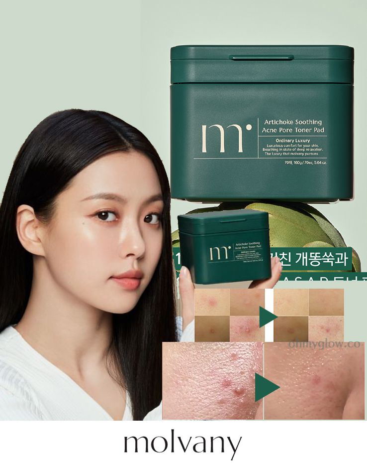 消炎抗痘鎮靜～韓國 MOLVANY Artichoke Soothing Acne Pore Toner Pad 高純度洋薊素魚腥草舒緩痘痘抗炎收毛孔爽膚棉片 - 70片裝