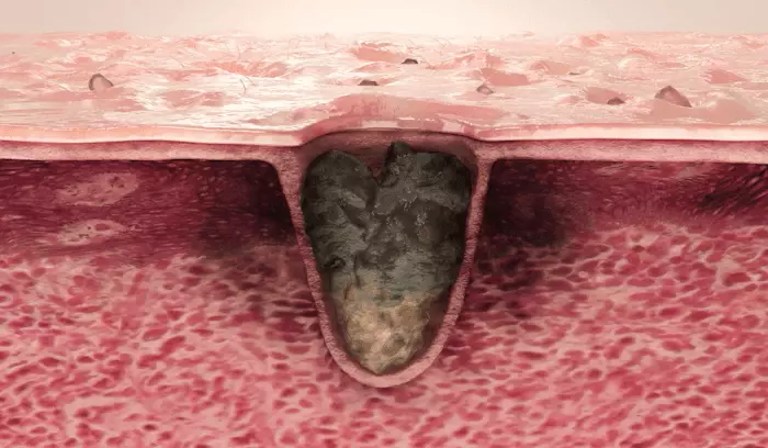 溫和版~韓國 medicube Zero Pore Mild Pad 零毛孔去角質毛孔管理爽膚棉片 70片裝