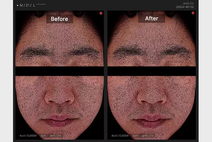 溫和版~韓國 medicube Zero Pore Mild Pad 零毛孔去角質毛孔管理爽膚棉片 70片裝