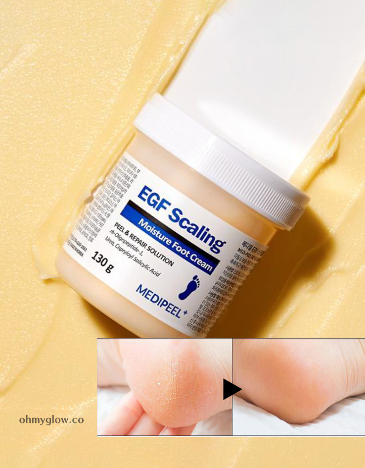 韓國 Medi Peel EGF Scaling Moisture Foot Cream 腳踭足部去角質龜裂保濕霜 130g