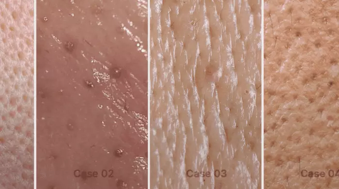 韓國 medicube Zero Pore One Day Cream ZERO果酸全效毛孔緊緻提拉面霜 - 50ml