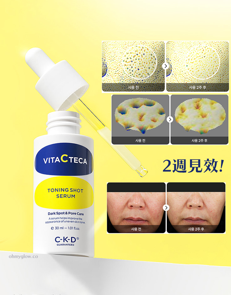 2週淡斑＋減紋收毛孔～韓國 CKD Guaranteed Vita C TECA Toning Shot Serum 99%高純度維C淡斑抗皺緊緻微針精華- 30ml