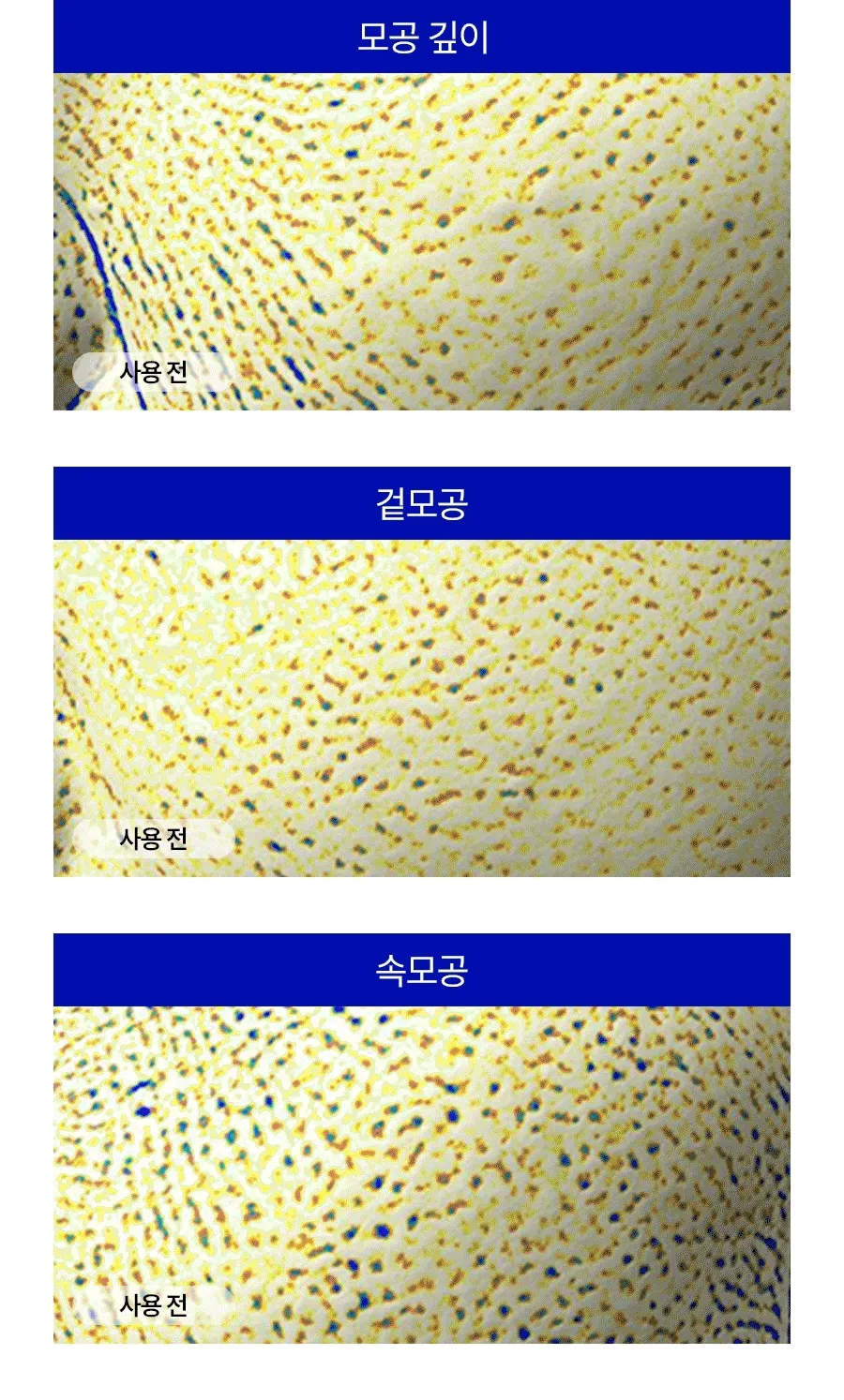 💦保濕收毛孔!韓國 Medi-Peel Hyaluronic Acid Layer Mooltox Ampoule 首創20層鎖水透明質酸保濕豐盈毛孔安瓶精華 - 30ML