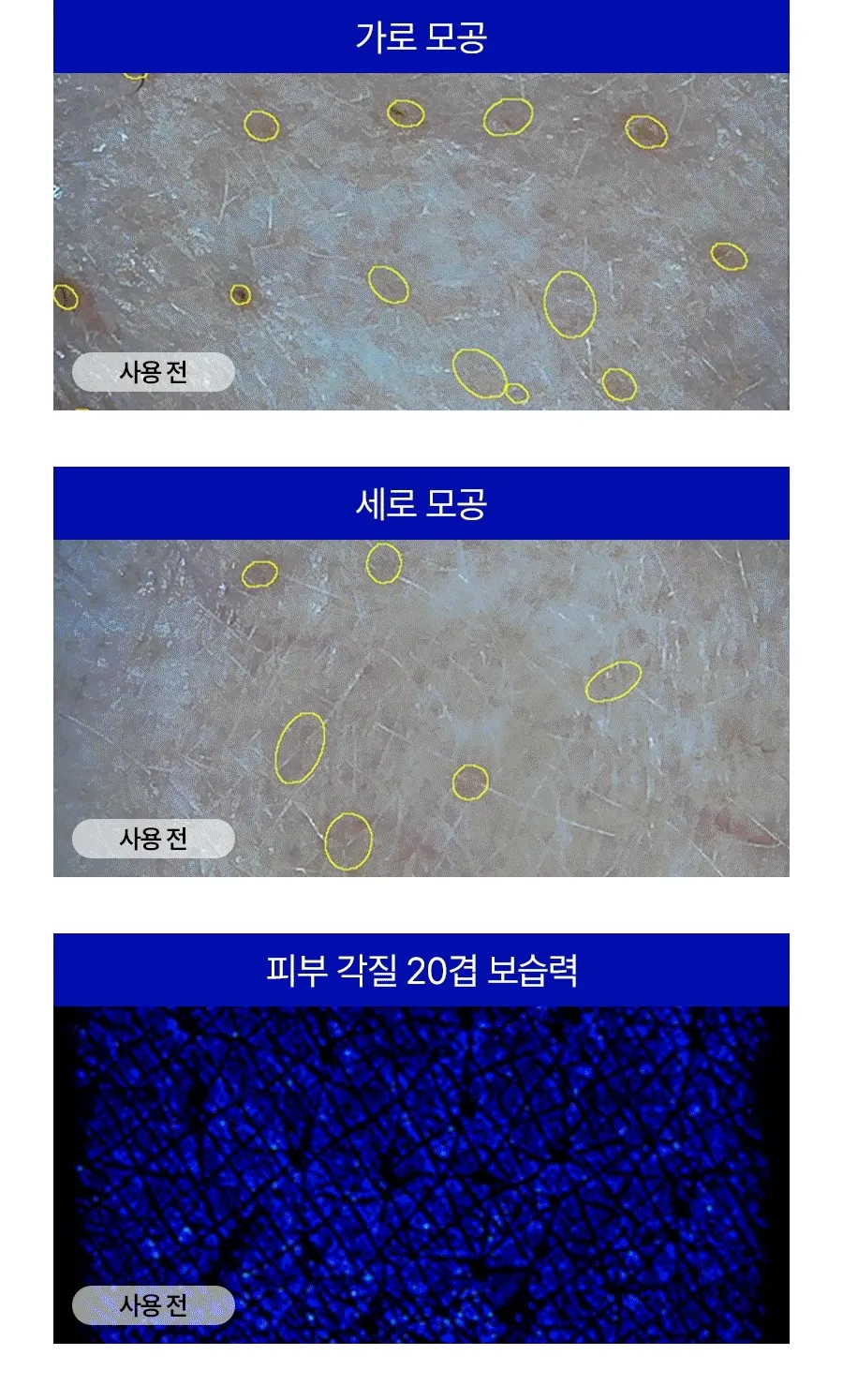 💦保濕收毛孔!韓國 Medi-Peel Hyaluronic Acid Layer Mooltox Ampoule 首創20層鎖水透明質酸保濕豐盈毛孔安瓶精華 - 30ML