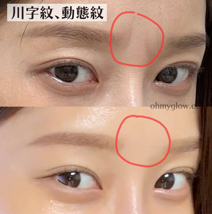 逆齡安瓶 2週密集提升～韓國 Sungboon Editor Silk Peptide Intensive Lifting Ampoule 專業級絲蛋白多胜肽高濃縮密集拉提安瓶 - 35ml