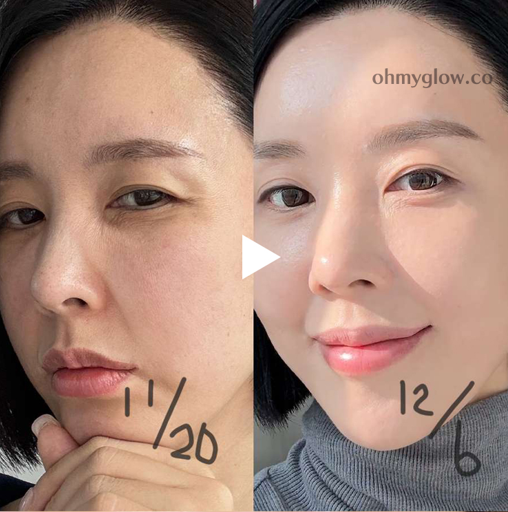 逆齡安瓶 2週密集提升～韓國 Sungboon Editor Silk Peptide Intensive Lifting Ampoule 專業級絲蛋白多胜肽高濃縮密集拉提安瓶 - 35ml