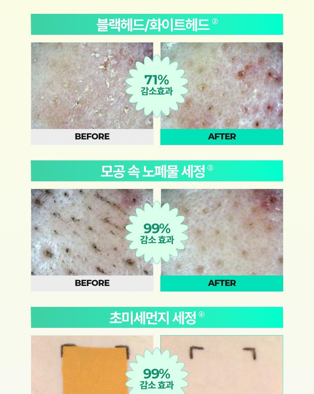 卸妝清黑頭~韓國 Bring Green Tea Tree Cica Deep Cleansing Oil 茶樹積雪草深清卸妝油 - 200ml