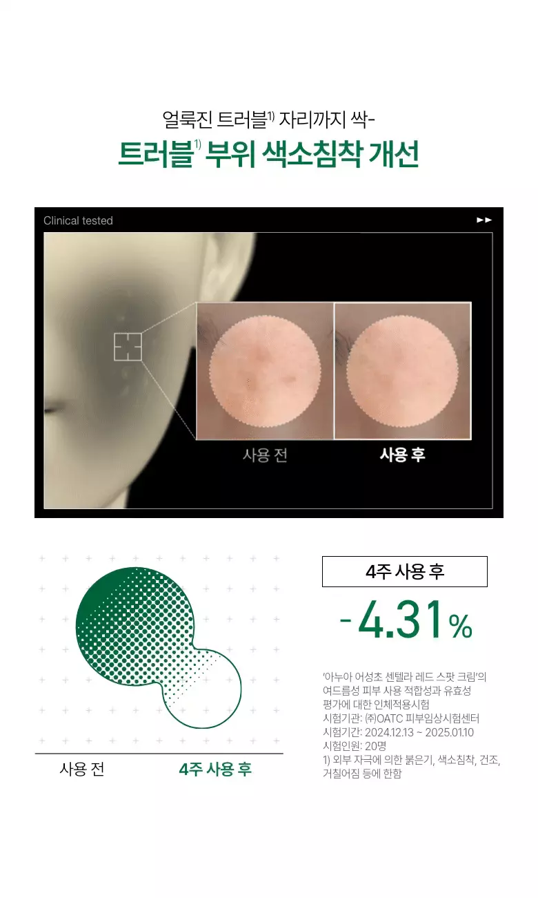 袪痘舒緩去紅～韓國 ANUA Heartleaf Centella Red Spot Cream 高濃度積雪草魚腥草痘痘舒緩去痘印修護霜 - 30g