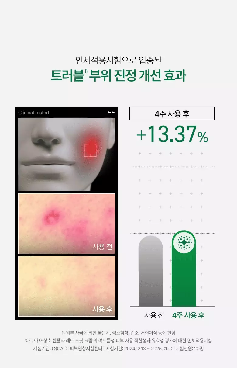 袪痘舒緩去紅～韓國 ANUA Heartleaf Centella Red Spot Cream 高濃度積雪草魚腥草痘痘舒緩去痘印修護霜 - 30g