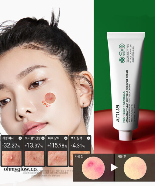 袪痘舒緩去紅～韓國 ANUA Heartleaf Centella Red Spot Cream 高濃度積雪草魚腥草痘痘舒緩去痘印修護保濕霜 - 30g
