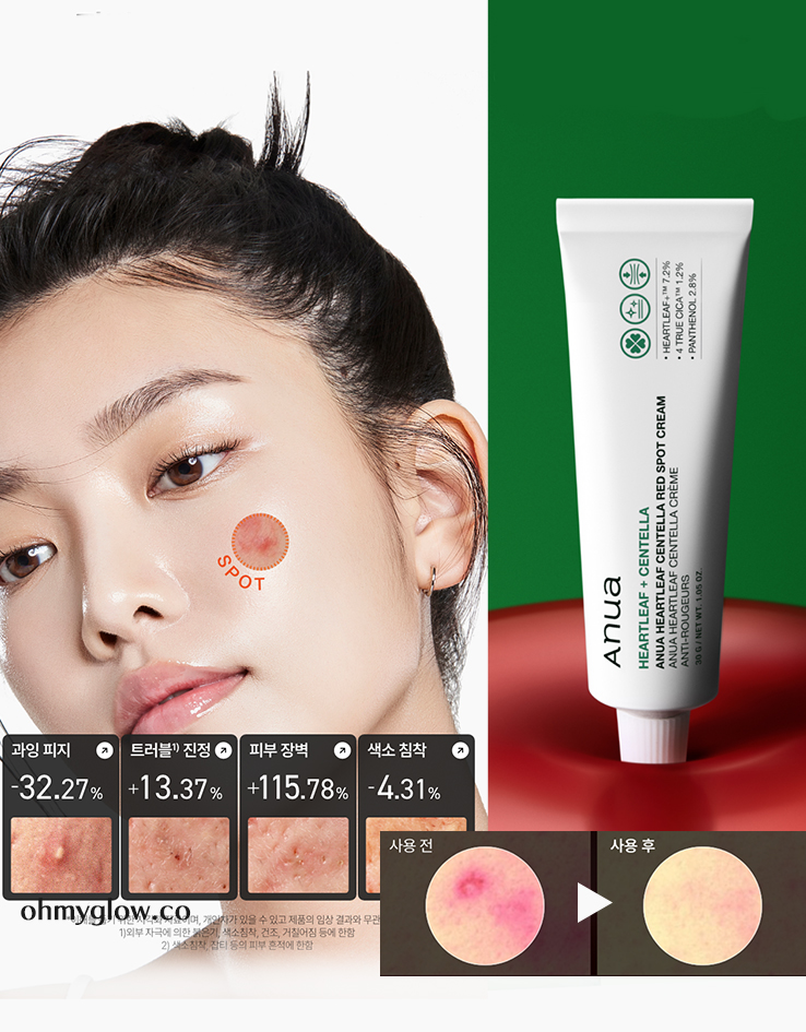 袪痘舒緩去紅～韓國 ANUA Heartleaf Centella Red Spot Cream 高濃度積雪草魚腥草痘痘舒緩去痘印修護保濕霜 - 30g