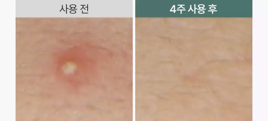 4重CICA EXOSOME精華🌿減紅降溫~敷後變透明 韓國 AROCELL CICA Repair Panthenol Gel Mask 積雪草舒緩修復保濕透氣第四代果凍面膜 一盒4片裝 - 2種選擇