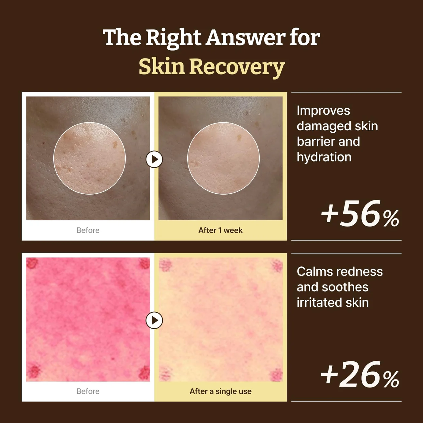 〖韓國藥房熱賣〗新版增量～Dr Rejuall Advanced PDRN Relief Cream 醫美級麗珠蘭成份高濃度PDRN再生修復霜 - 30ml