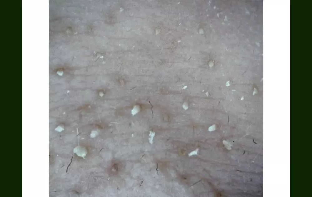 研磨石潔面膏～韓國 beplain Mung Bean Pore Grinding Cleansing Balm 綠豆清毛孔卸妝潔面膏 - 100ml