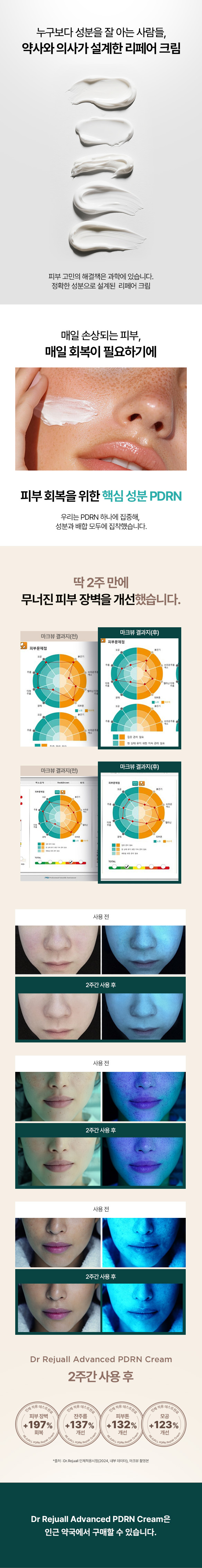 〖韓國藥房熱賣〗Dr Rejuall Advanced PDRN Relief Cream 醫美級麗珠蘭成份高濃度PDRN再生修復霜 - 20g