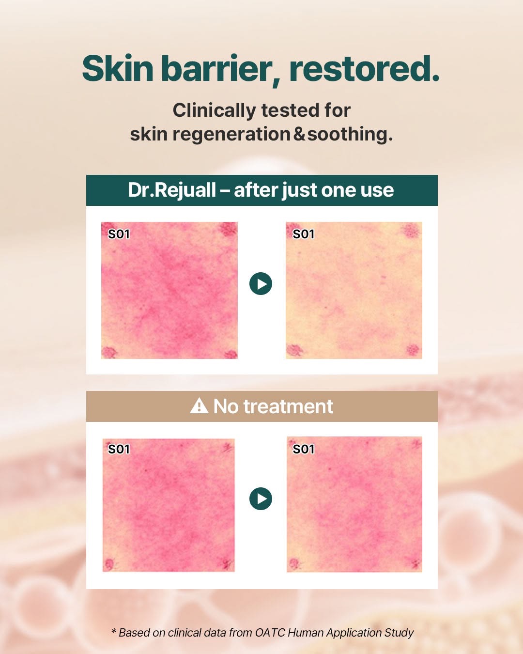 〖韓國藥房熱賣〗Dr Rejuall Advanced PDRN Repair Cream 醫美級麗珠蘭成份高濃度PDRN再生修復霜 - 20g