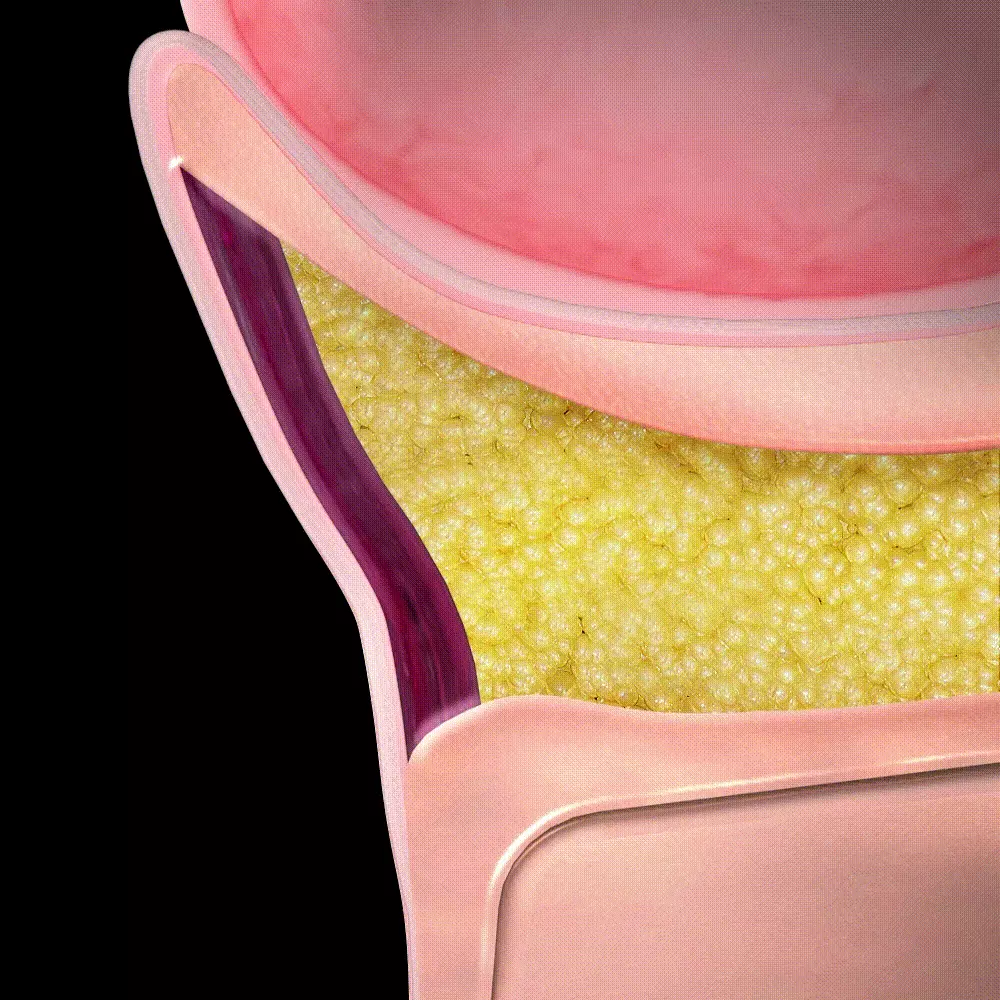 1秒賣出1瓶!眼袋凹陷、撫平眼紋、收緊眼袋~韓國 Sungboon Editor Silk Peptide Intensive Eye Cream 專業級絲蛋白幹細胞多胜肽密集修復眼霜