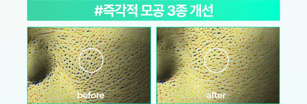 【送清黑頭皮脂棒】GlowPick🏆 韓國 Bring Green Tea Tree CICA Sebum Cleansing Gel (+Sebum Cleaner Set) 樹茶積雪草潔面皮脂軟化深清毛孔黑頭凝膠凝膠 - 50ml