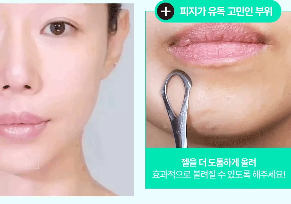 【送清黑頭皮脂棒】GlowPick🏆 韓國 Bring Green Tea Tree CICA Sebum Cleansing Gel (+Sebum Cleaner Set) 樹茶積雪草潔面皮脂軟化深清毛孔黑頭凝膠凝膠 - 50ml