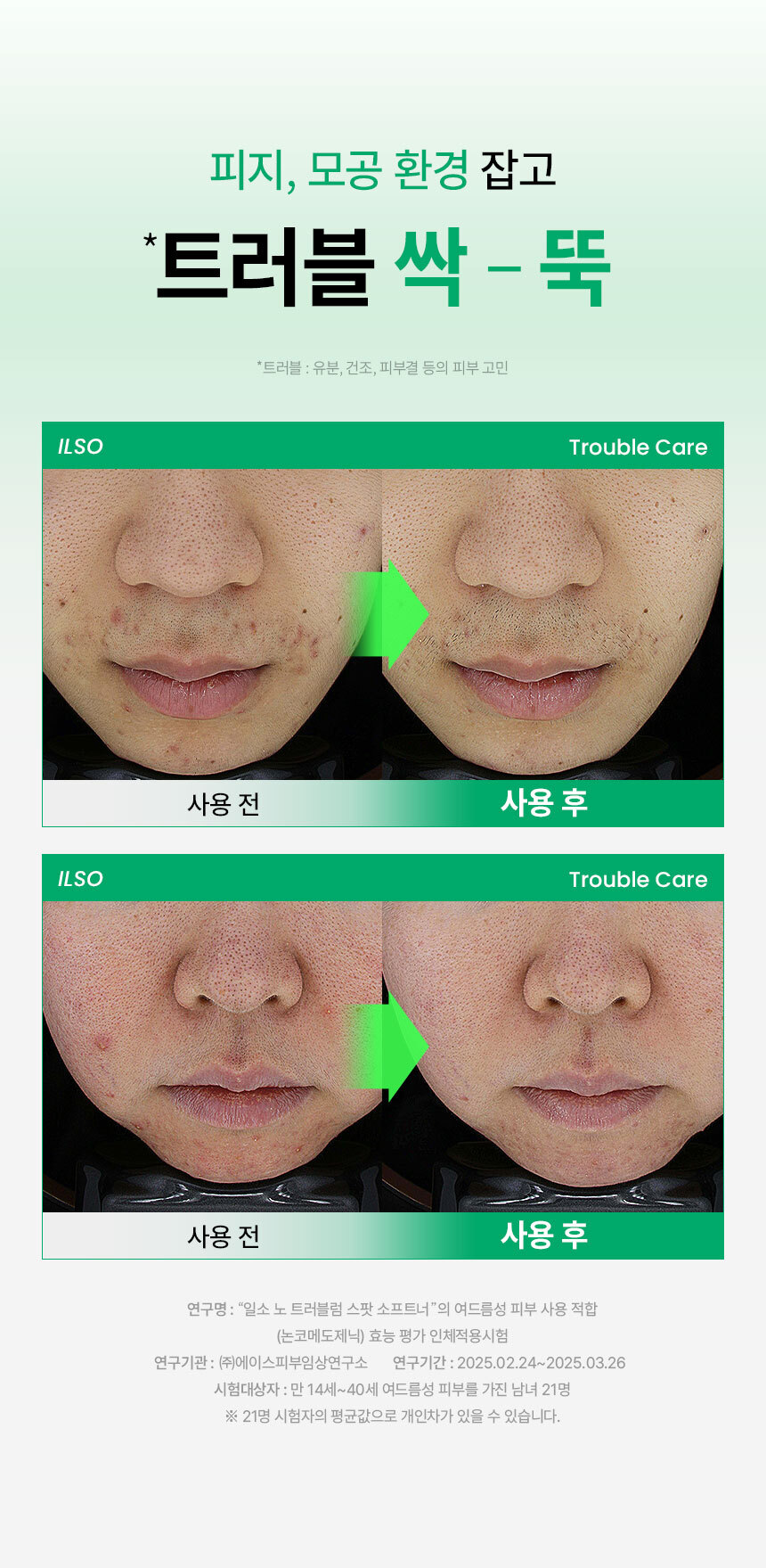 10分鐘痘痘敏感CLEAR！～韓國 ilso No Problem Spot Softener 芽萃清涼舒緩痘痘護理濕敷安瓶精華面膜水 - 150g