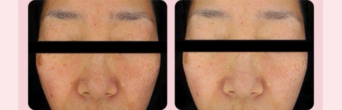 下單照價93折! 韓國 medicube Age-R Booster Pro Mini 多用途美容儀迷你版