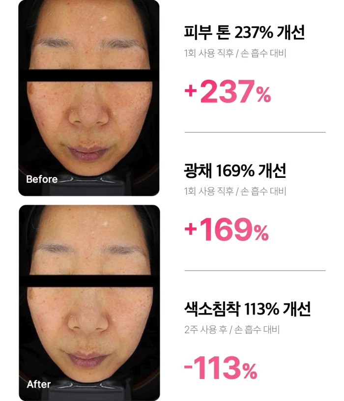 下單照價93折! 韓國 medicube Age-R Booster Pro Mini 多用途美容儀迷你版