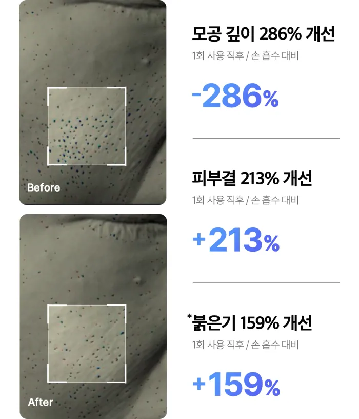 下單照價93折! 韓國 medicube Age-R Booster Pro Mini 多用途美容儀迷你版