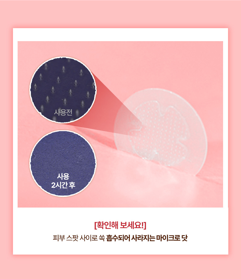 夜間急救消痘～Care Plus Zinc Trouble Micro-dot Patch 水楊酸 醉PCA 微針導入消痘痘暗瘡貼 - 24片裝 