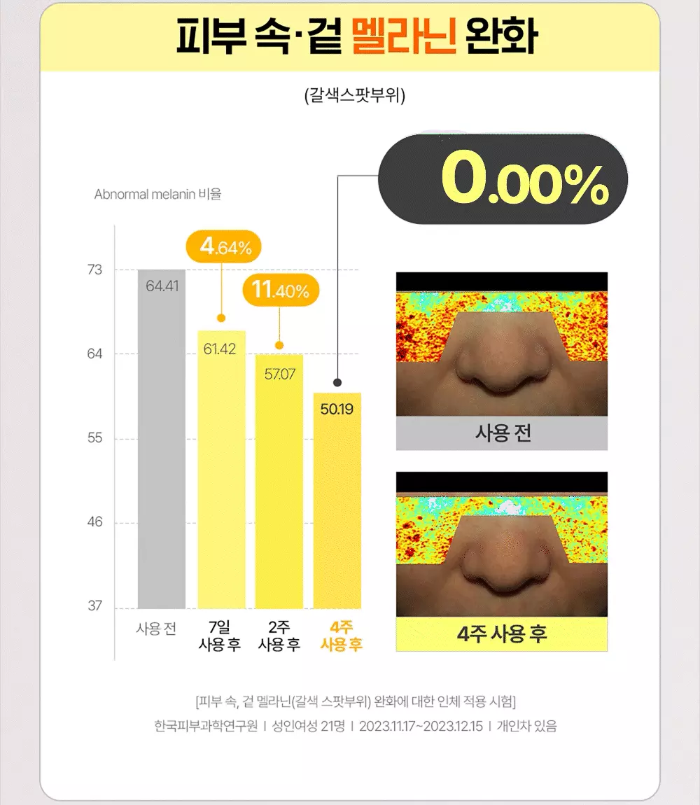 加強修護版 7日有感～韓國 Goodal Green Tangerine VITA C 27% Dark Spot Care Ampoule 高濃度青橘純維他命C 27%淡斑修護安瓶 