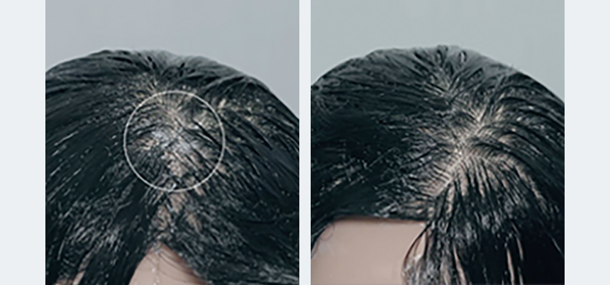 去頑固油垢~韓國 Growus Sea Salt Therapy Scalp Scaler 天然海洋礦物海鹽深清頭皮角質護理 - 250g