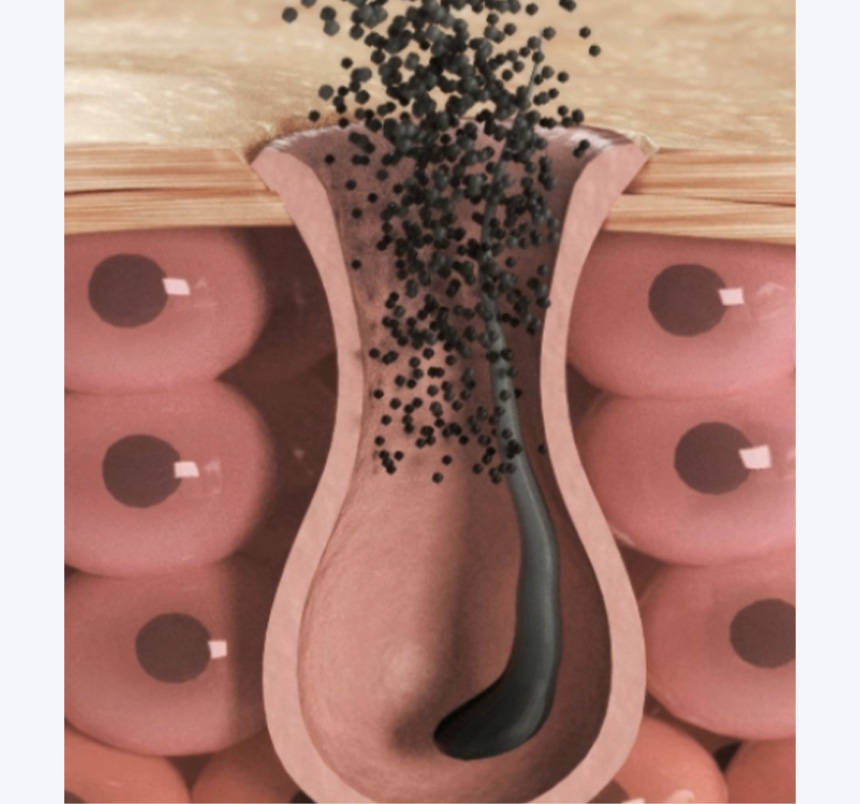 去頑固油垢~韓國 Growus Sea Salt Therapy Scalp Scaler 天然海洋礦物海鹽深清頭皮角質護理 - 250g