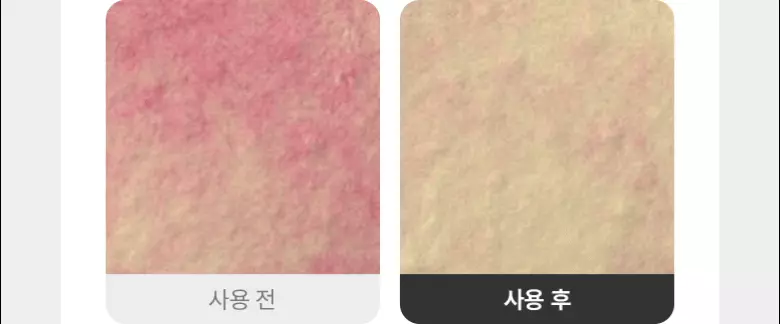 一次即見效!內含10億個高純度Cica外泌體~ 韓國 Bio Heal BOH Panthecell Repair Cica-some Ampoule 泛醇X積雪草外泌體痕跡修復保濕舒敏安瓶精華