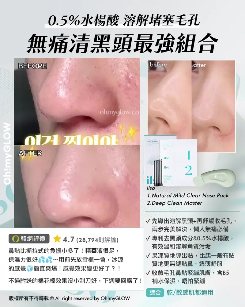 炎夏毛孔拯救隊來襲 OMG教你從內到外K.O.毛孔 呢個夏日重拾無瑕美肌 0.5%水楊酸 溶解堵塞毛孔 無痛清黑頭最強組合 ilso 1.Natural Mild Clear Nose Pack 2.Deep Clean Master 適合 乾/敏感肌都適用
