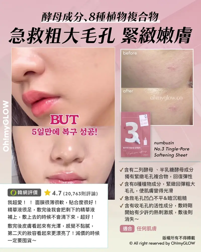 炎夏毛孔拯救隊來襲 OMG教你從內到外K.O.毛孔 呢個夏日重拾無瑕美肌 酵母成分、8種植物複合物 急救粈大毛孔 緊緻嫩膚 numbuzin No.3 Tingle-Pore Softening Sheet 適合 任何肌膚