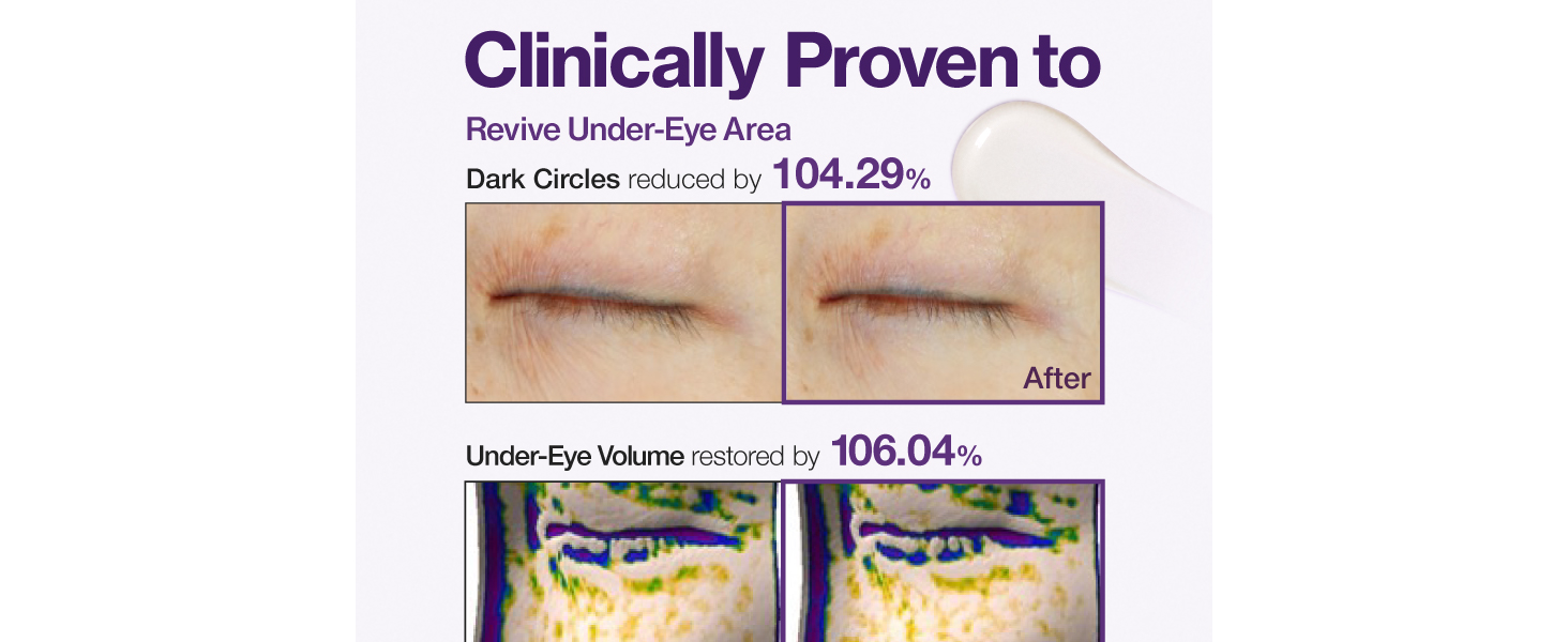 集中撫平眼周紋 減淡黑眼圈 韓國numbuzin No.9 NAD+ Retinol Volumetox Eye Cream 高效NAD維A胜肽抗老緊緻眼紋逆齡眼霜