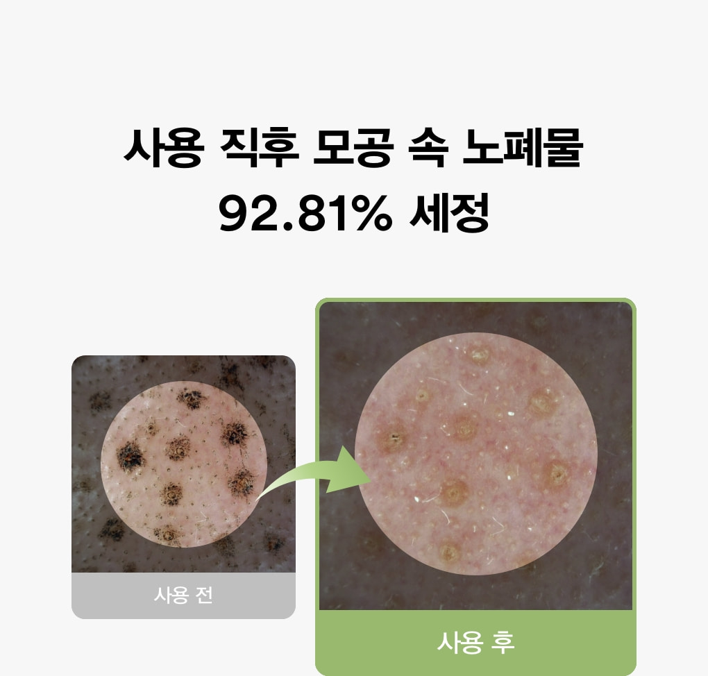 1分鐘深清〖泥膜 X 潔面 2合1〗韓國 ABIB Pore Clay Pack Cleanser 95%高純度活性炭粉魚腥草膠囊潔淨毛孔吸油泥面膜潔面乳