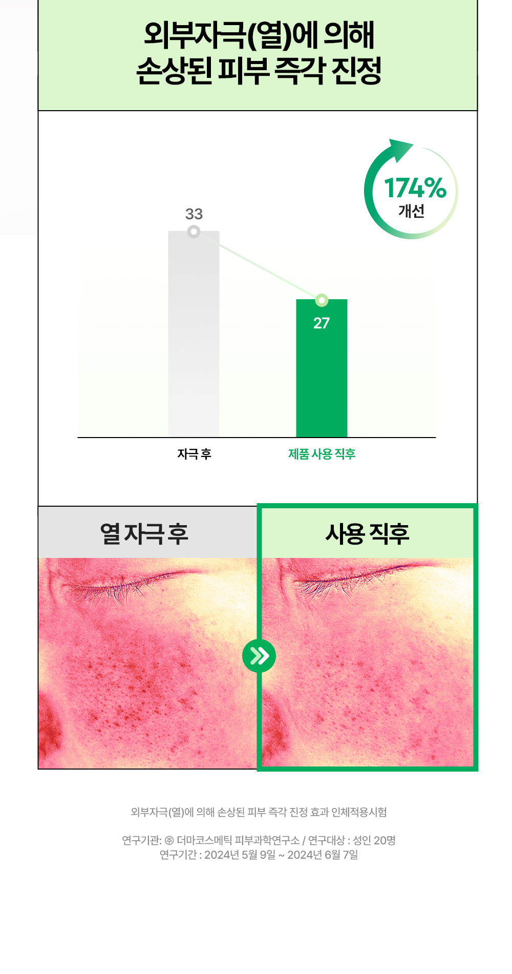 舒緩淡印去暗沉~韓國 DEWYTREE AC DEEP BLEMISH CALMING MASK 深層淡瑕鎮靜積雪草面膜 一盒10片裝 - 2種選擇