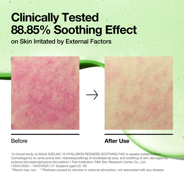 韓國 ANUA Azelaic 10 Hyaluron Redness Soothing Pad 壬二酸透明質酸積雪草去紅抗痘爽膚棉片 - 90片裝