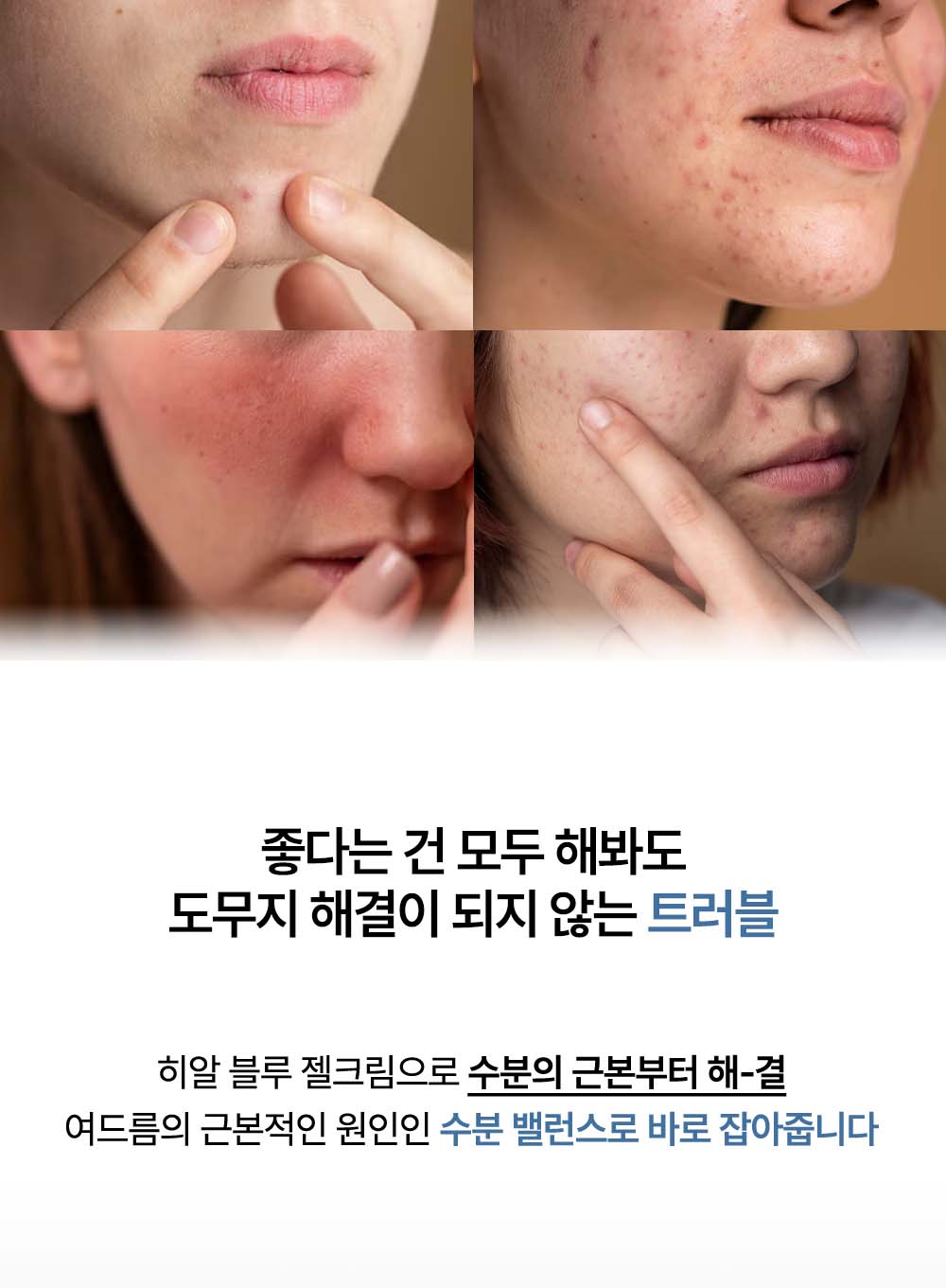 韓國 HEVEBLUE Phyton Squa Hyal Blue Gel Cream 天然藍色透明質酸新芽深層補水抗痘舒敏水凝面霜 - 110ml