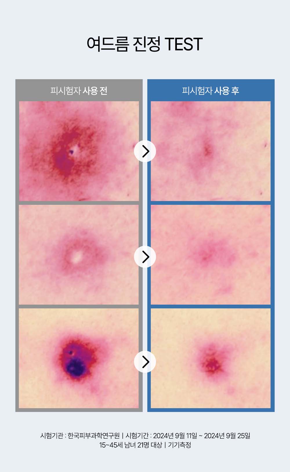 韓國 HEVEBLUE Phyton Squa Hyal Blue Gel Cream 天然藍色透明質酸新芽深層補水抗痘舒敏水凝面霜 - 110ml