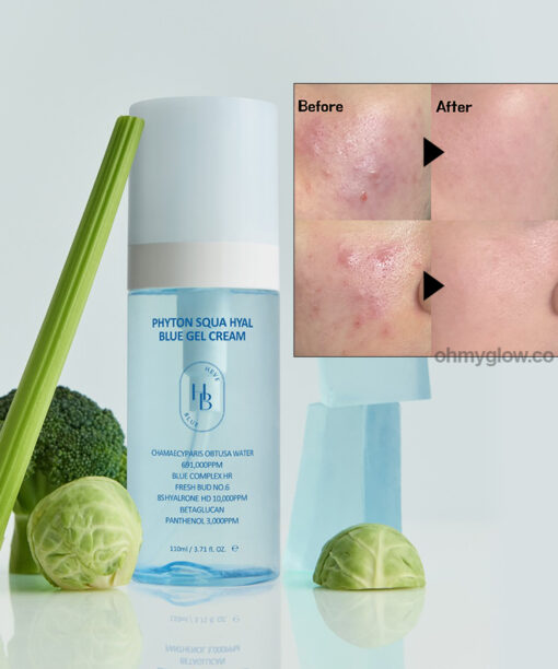 推介痘敏肌～韓國 HEVEBLUE Phyton Squa Hyal Blue Gel Cream 天然藍色透明質酸新芽深層補水抗痘舒敏水凝面霜 - 110ml