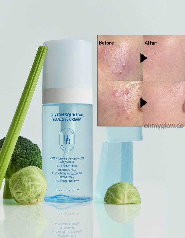 推介痘敏肌～韓國 HEVEBLUE Phyton Squa Hyal Blue Gel Cream 天然藍色透明質酸新芽深層補水抗痘舒敏水凝面霜 - 110ml