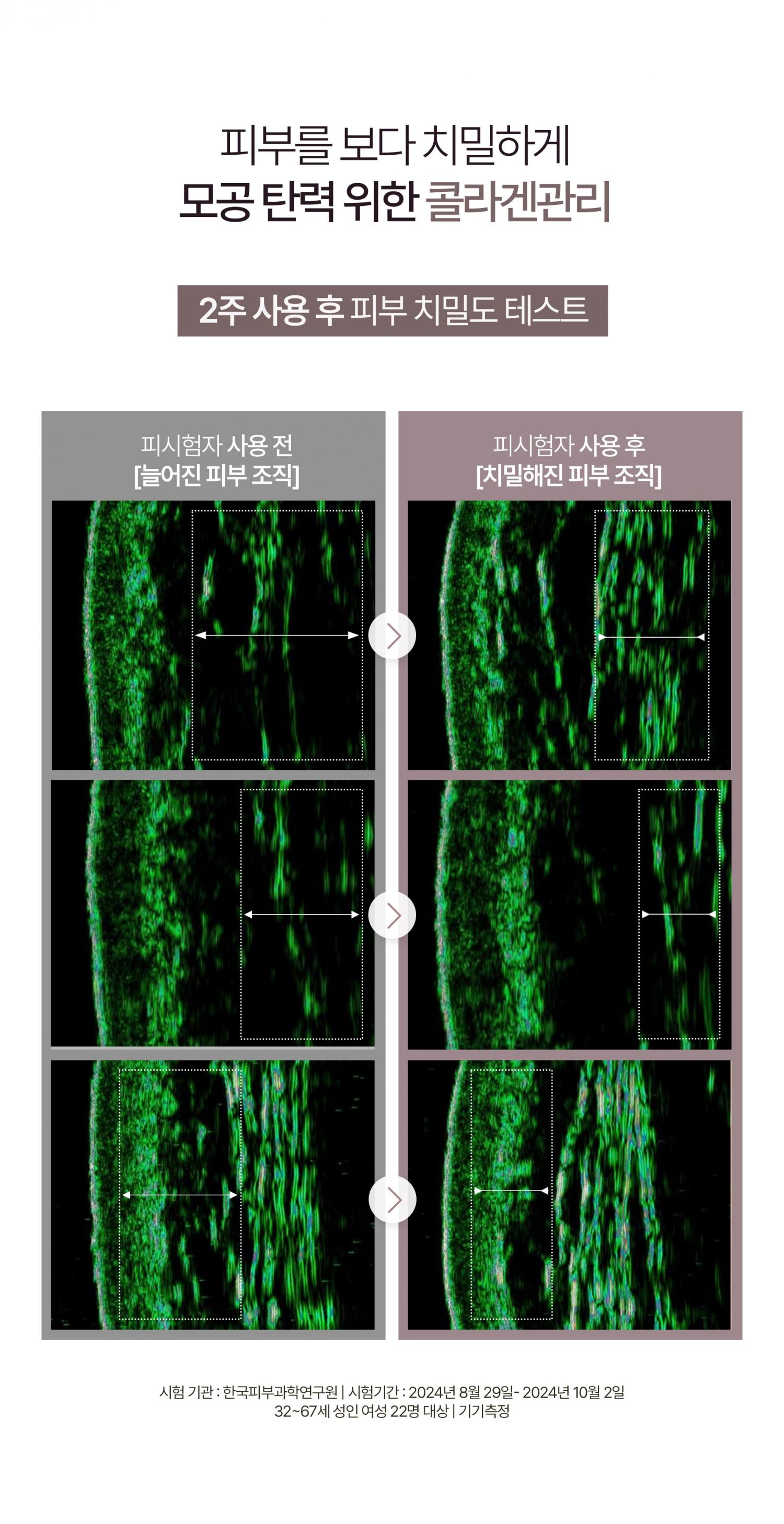 敷後變透明 第二朝毛孔緊緻有光澤~ 韓國 HEVEBLUE Pot Pore Peptamin Hydro Collagen Mask Pack 天然紅豆深層收毛孔膠原蛋白果凍面膜 4片裝 - 2種選擇