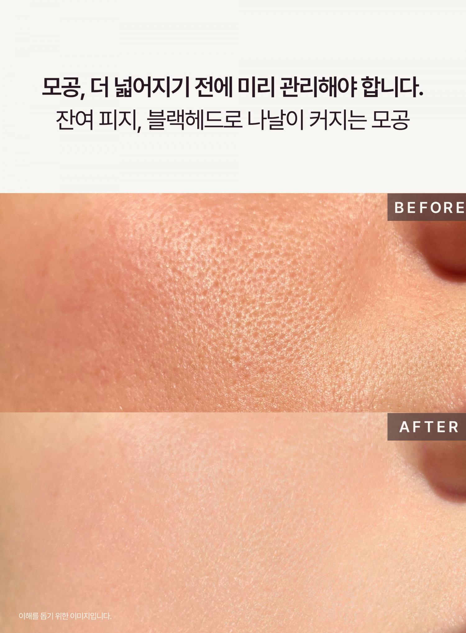 敷後變透明 第二朝毛孔緊緻有光澤~ 韓國 HEVEBLUE Pot Pore Peptamin Hydro Collagen Mask Pack 天然紅豆深層收毛孔膠原蛋白果凍面膜 4片裝 - 2種選擇