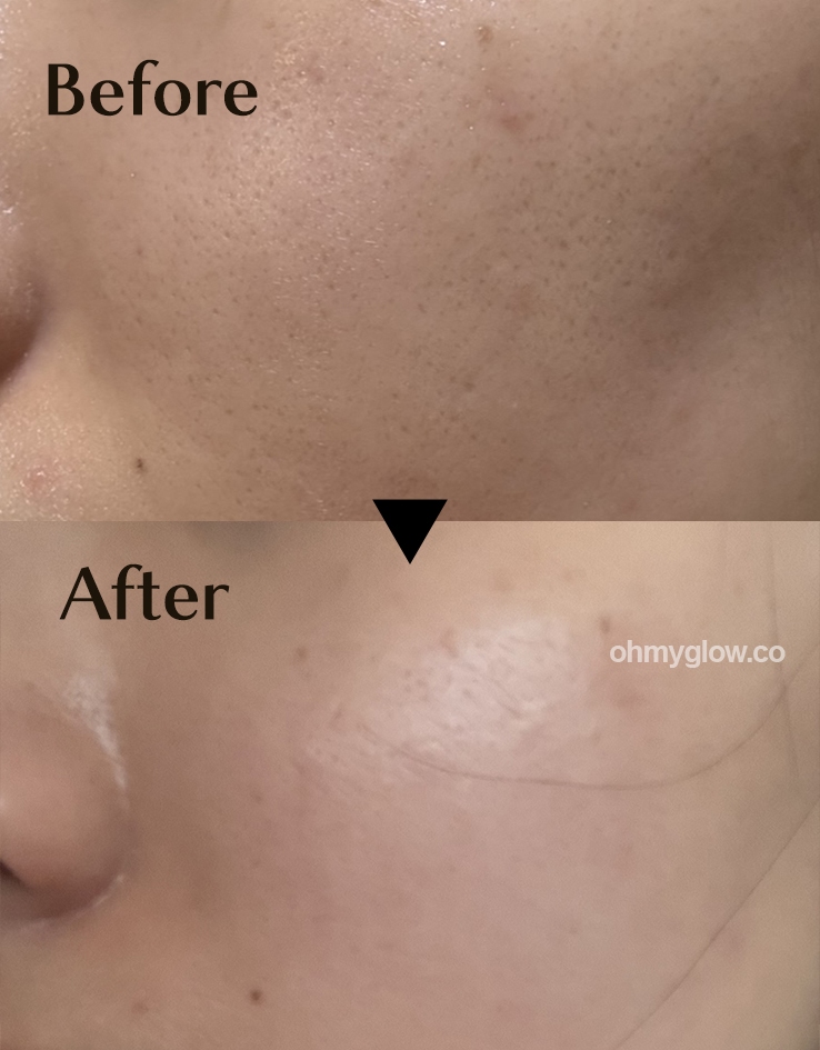 敷後變透明 第二朝毛孔緊緻有光澤~ 韓國 HEVEBLUE Pot Pore Peptamin Hydro Collagen Mask Pack 天然紅豆深層收毛孔膠原蛋白果凍面膜 4片裝 - 2種選擇