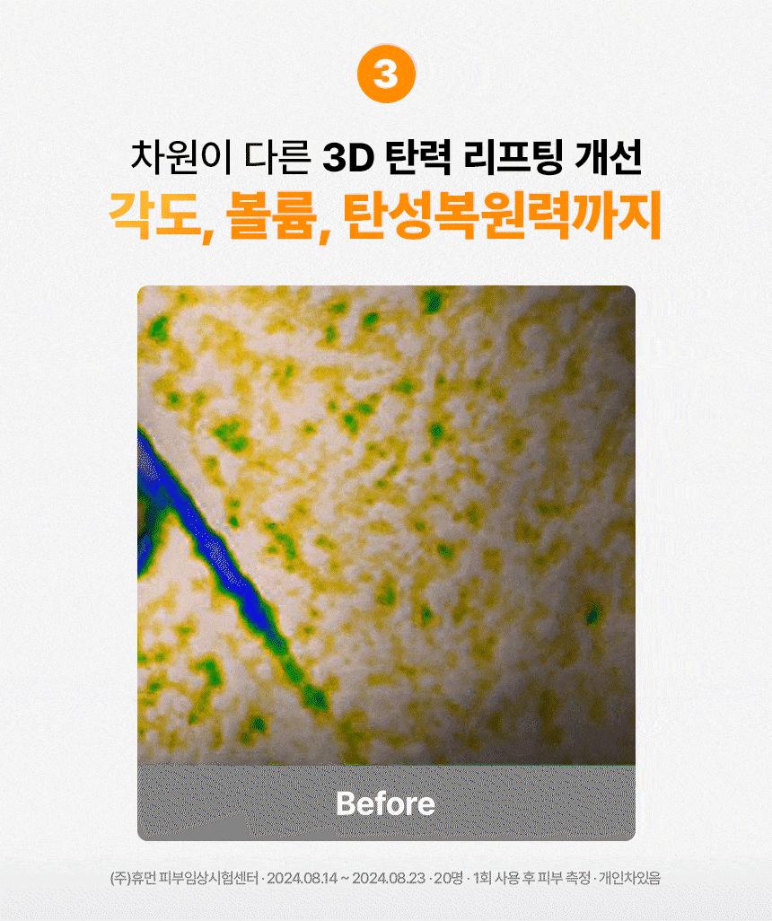 專利吸收技術+300Da 專利超細分子納米膠原~韓國 MediAnswer Vita Collagen Nanoshot Mask 維C脂質體提亮 X 緊緻彈力果凍面膜 1盒5片裝 - 2種選擇