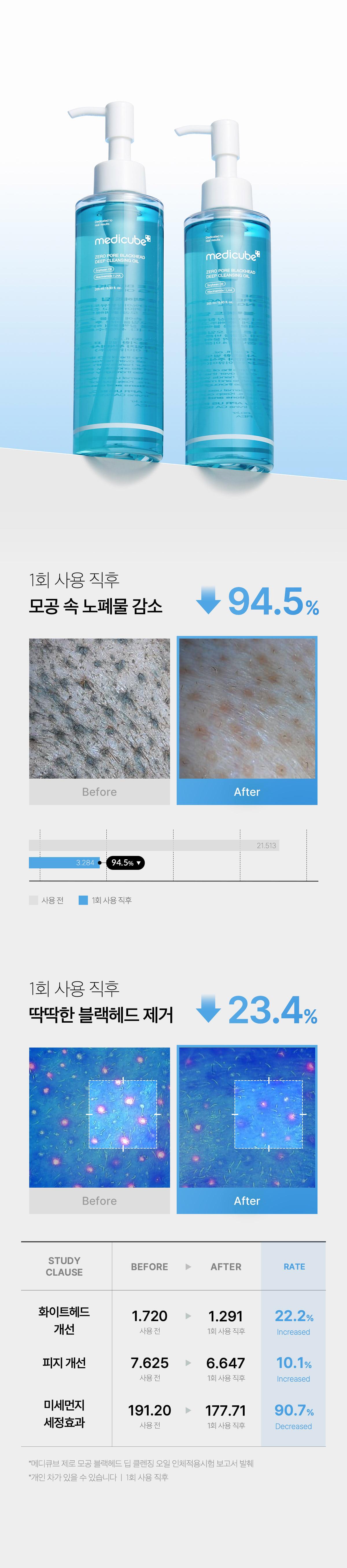 韓國 medicube Zero Pore Blackhead Deep Cleansing Oil 零毛孔黑頭深清卸妝油 - 205ml