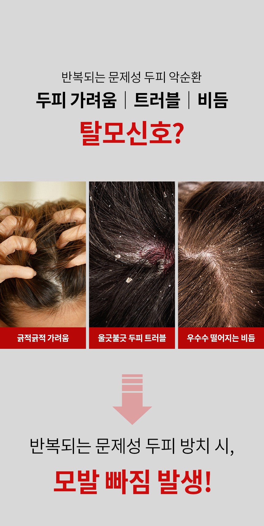 針對敏感&頭皮炎症問題~韓國 ViveLab Recovery Clinic Sensitive Scalp SOS Solution Hair Tonic SOS頭皮舒敏急救噴霧