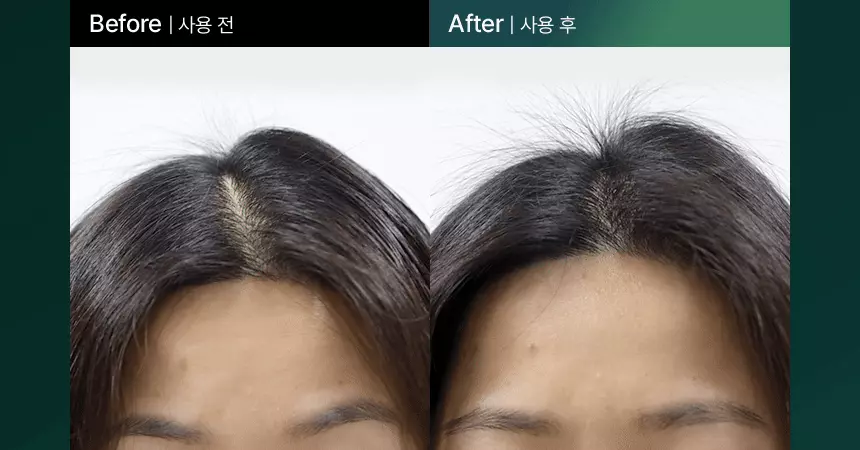 4週阻截脫髮～韓國 ViveLab 回購No.1 Revi Solution Anti Hair Loss Scalp Shampoo 專利防脫護頭皮綠色洗髮露 (500ml/300ml/60ml) - 3種選擇