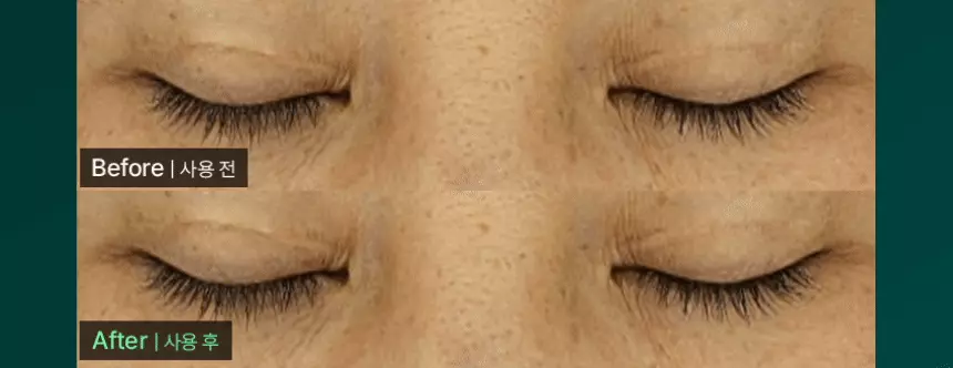 韓國 vivelab Revive Therapy Hair Brow Lash Serum 皇牌育睫高濃縮眉睫精華液
